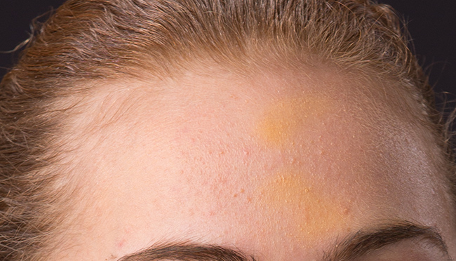 Original unretouched image